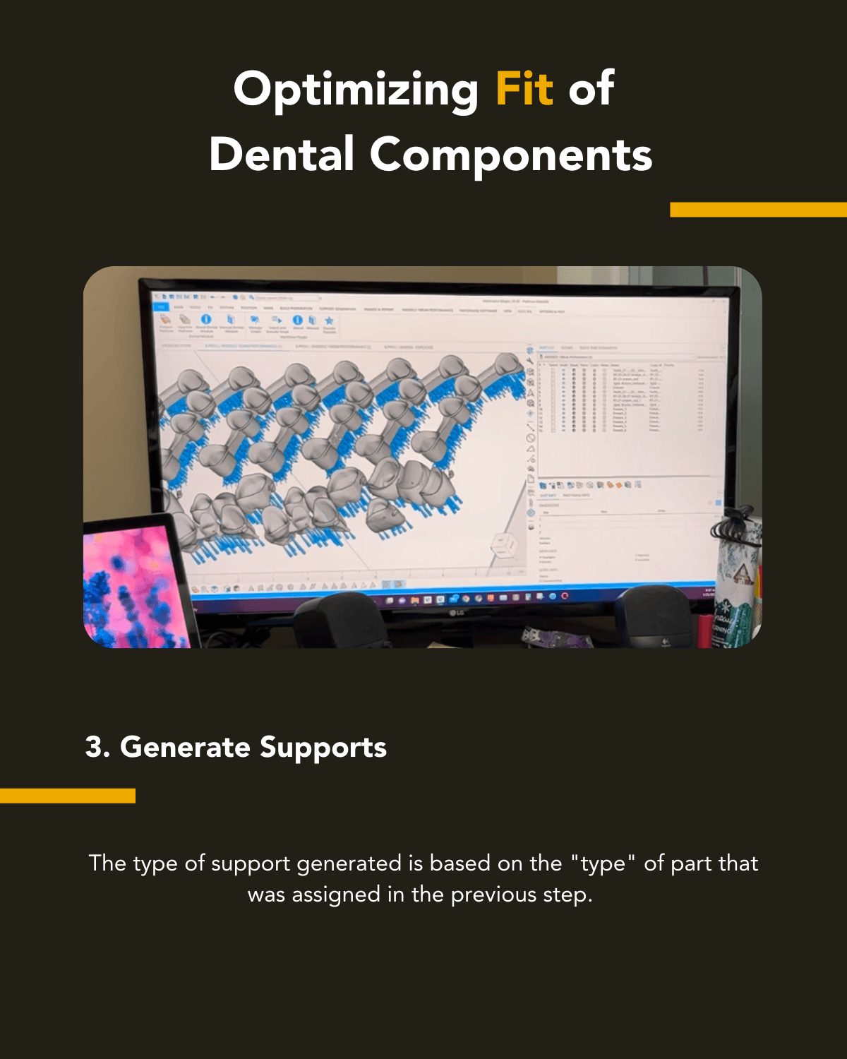 Step Three in Optimizing Dental Components for Metal 3D Printing